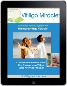 Vitiligo Miracle product image
